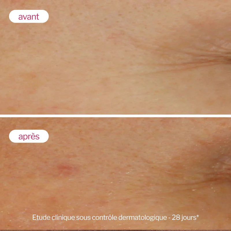 NOVEXPERT SÉRUM BOOSTER à l'Acide Hyaluronique - 30ml