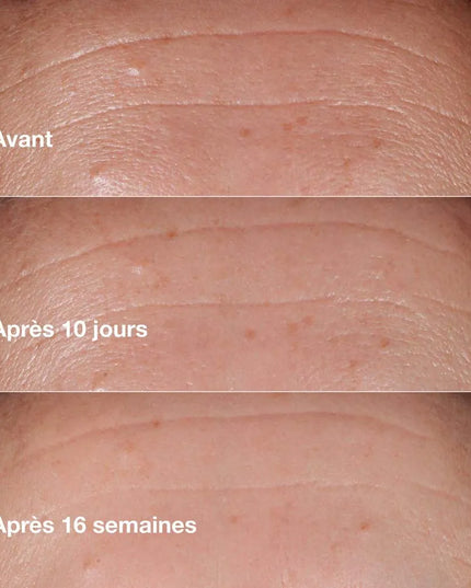 CLINIQUE SMART CLINICAL REPAIR Sérum Correcteur Anti-rides - 30ml