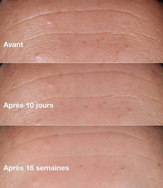 CLINIQUE SMART CLINICAL REPAIR Sérum Correcteur Anti-rides - 30ml