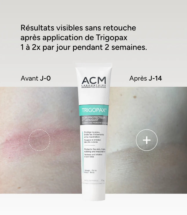 ACM TRIGOPAX Soin Protecteur Apaisant - 75g