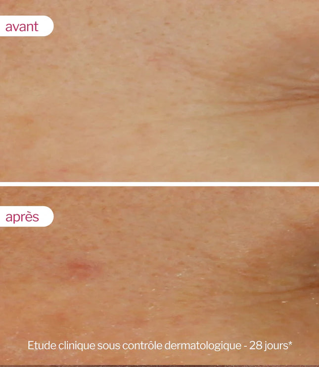 NOVEXPERT SÉRUM BOOSTER à l'Acide Hyaluronique - 30ml